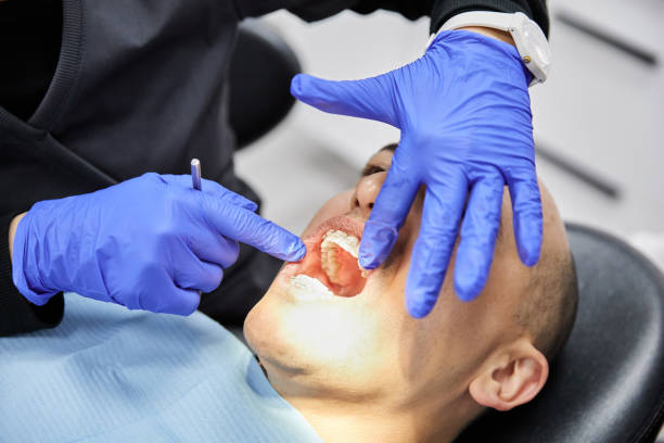 Best Emergency Gum Treatment in Newcastle, WA