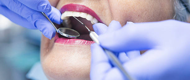 Best Emergency Tooth Extraction in Newcastle, WA